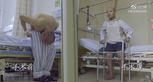 身體被敲斷4次的折疊人出院，打開折疊人生(圖15)