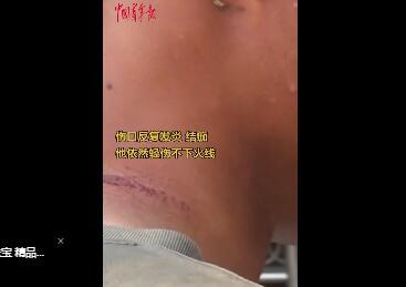抗洪戰(zhàn)士疼得直叫依然說沒事兒 現(xiàn)場圖曝光令人鼻酸(圖2) 抗洪戰(zhàn)士疼得直叫依然說沒事兒 現(xiàn)場圖曝光令人鼻酸(圖2)
