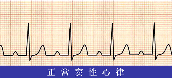 救命神器AED有多重要——你認(rèn)識(shí)它嗎？(圖6)